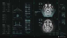 an image of the inside of a human head with various diagrams and graphs on it