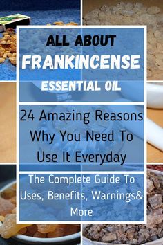 Learn About Frankincense Essential Oil. Everything You Wanted To Know Of Frankincense Essential Oil. Here Is a guide to essential oil you wish you knew before: Frankensense Oil Benefits, Benefits Of Frankincense Essential Oil, Benefits Of Frankincense, Frankincense Essential Oil Benefits, Top Essential Oils, Essential Oils For Pain, Doterra Essential Oils Recipes, Essential Oil Diffuser Blends Recipes