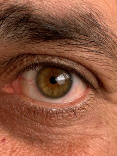 an extreme close up shot of a man's green eye with brown patches on the iris