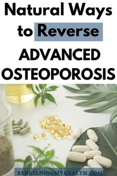 Reverse Osteoporosis Natural, 30 A Florida, Osteoporosis Symptoms, Hand Health