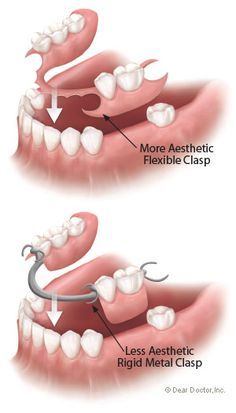 Dental Room, Dental Assistant Study, Dental Images, Dental Education, Dental Assisting, Dental Work, Partial Dentures, Kedokteran Gigi