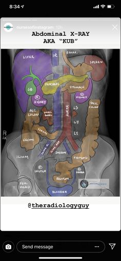 the radiology app shows an overview of the human body's organs and their functions