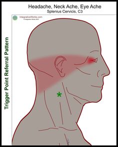 Neck-ache Headache, Eye-ache - Integrative Works