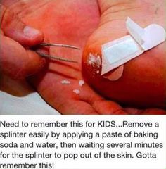 Splinter Removal, First Aid Tips, Sick Remedies, Survival Skills Life Hacks, Baby Life Hacks, Survival Life Hacks, Home Health Remedies, Everyday Hacks, Simple Life Hacks