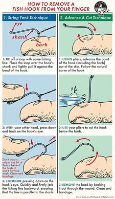 instructions for how to remove a fish hook from your finger with an adhesivee