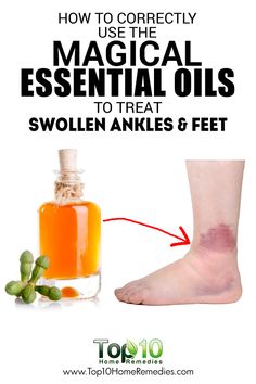 How to Use Essential Oils to Treat Swollen Ankles and Feet Feet Remedies, Essential Oils For Pain, Essential Oil Remedy, Oil Remedies, Essential Oils Health, Yl Essential Oils, Young Living Oils, Doterra Oils