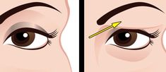 Saggy Eyelids, Sagging Eyelids, Drooping Eyelids, Droopy Eyelids, Droopy Eyes, Eye Exercises, Organic Remedy, Makijaż Smokey Eye, Beauty Remedies