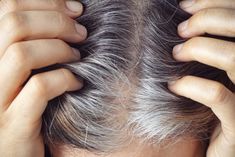 How to use baking soda for gray hair Cover Gray Hair Naturally, Grey Hair Remedies, Homemade Hair Mask, Help Hair Grow, Grey Hair Dye, Homemade Mask, Natural Gray Hair, Homemade Hair Products