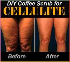 Review on coffee scrub for cellulite before and after results. In my hunt for a natural yet effective cellulite removal remedy, I’ve c Coffee Scrub Diy, Coffee Body Scrub, Diy Kosmetik, Coffee Scrub, Natural Beauty Tips, Face Scrub, Skin Care Regimen, Vaseline, Way Of Life