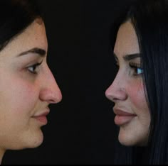 Facial Surgery, Facial Fillers, Facial Contouring