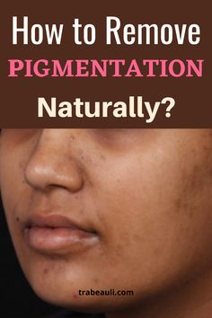 Dark Patches On Face, Removing Hyperpigmentation, Natural Beauty Remedies, Brown Spots On Face