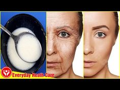 Apply This Mixture Of 3 Ingredients - Removes Wrinkles On The Face And Makes You Younger - YouTube Face In Ice, Mouth Wrinkles, Diy Wrinkles, Wrinkle Remedies, Anti Aging Secrets, Facial Wrinkles