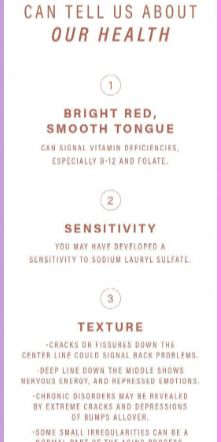 What Your Tongue is Trying to Tell You About Your Health – Koperacija The tongue analysis comes from the antiquated therapeutic routine with regards to Ayurveda, a framework that underpins generally... Improve Nutrition, Ayurvedic Doctor, Health Guru, Home Beauty Tips, Physical Change, Color Meanings, The Tongue