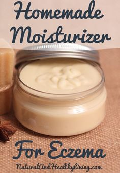 Homemade Eczema Cream - All Natural Lotion Safe for kids! All Natural Lotion, Natural Lotion, Homemade Moisturizer, Anti Itch Cream, Diy Lotion, Diy Kosmetik, Homemade Lotion, Diy Remedies