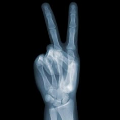 an x - ray image of a hand making the peace sign