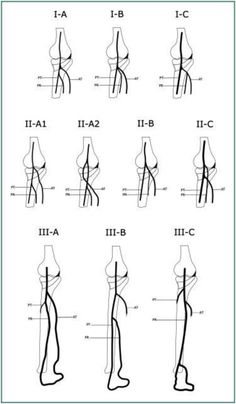 an image of the human body with different types of legs and arms, all labeled in black