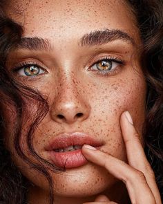 a woman with freckles on her face and hands near her face, looking at the camera