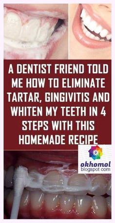 Heal Cavities, Homemade Recipe, Healthy Teeth, Health Advice, Dental Health, Health Remedies