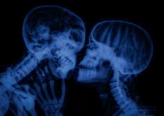 two skeletons with their heads touching each other's foreheads in front of a black background