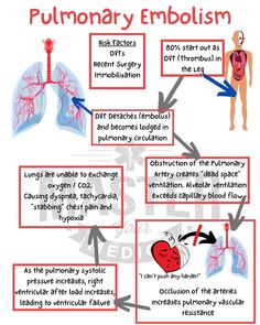 the diagram shows how to use an embolism system for breathing and heart health