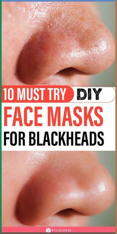 10 Must Try DIY Face Masks For Blackheads : Blackheads are a mild form of acne.They are formed when your skin pores are clogged due to the oversecretion of oil and sebum. If you don’t know where to begin, we have a list of DIY blackhead removal mask recipes for you. Take a look! #skincare #beauty #blackheads #acne #skinacne #diy #facemasks Face Masks For Blackheads, Masks For Blackheads, Removing Blackheads, For Blackheads, Face Mask For Blackheads, Black Heads, Natural Sleep Remedies