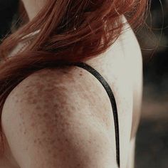 the back of a woman's head with freckles on her body and hair