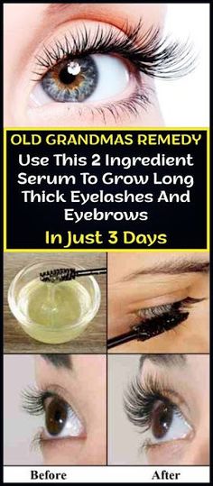 Old Grandmas 2 Ingredient Homemade Remedy To Grow Long Thick Eyelashes And Eyebrows In Just 3 Days Grow Longer Thicker Eyelashes, Make Hair Grow Faster, Long Thick Eyelashes, Quick Hair Growth, Diy Serum, Eyelashes And Eyebrows, Thick Eyelashes, Make Hair Grow, Skin Care Routine For 20s