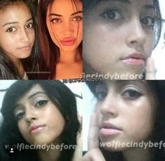 Cindy Kimberly Before And After Surgery, T A T U, Plastic Surgery Aesthetic, Instagram Vs Real Life