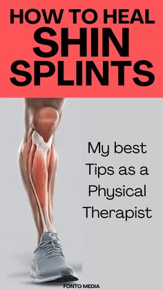 shin splints, tibia fracture, stress fracture, exercice, physical therapy Chin Splints Remedy, Shin Splint Relief, Knee Strengthening Exercises