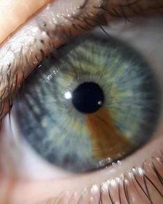 Iris Reference, Eyes References, Multicolored Eyes, Eye Photos, Rare Eye Colors, Iris Eye, Eye Color Chart, Rare Eyes, Beautiful Eyes Color