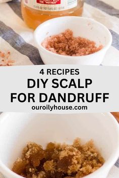 DIY scalp scrubs can easily be made at home, are cost-effective, and can help with dandruff. Made with nourishing ingredients and essential oils that can strengthen hair and keep the scalp healthy. Scalp Scrub For Dandruff, Diy Scalp Scrub, Help With Dandruff, Diy Hair Scrub, What Causes Dandruff, Diy Hair Care Recipes, Homemade Conditioner, Oils For Dandruff, Exfoliate Scalp