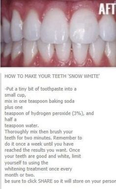 Whiten Teeth At Home, Natural Teeth Whitening Remedies, Teeth Whitening Methods, Cleaning Advice, Whiten Teeth, Tooth Sensitivity