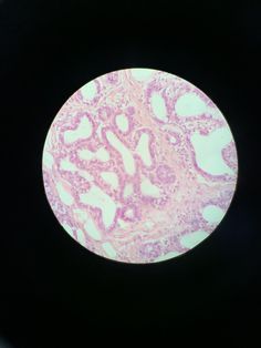 an image of the inside of someone's stomach with pink and white patterns on it