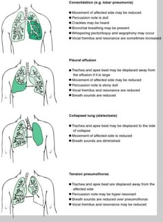 the diagram shows how lungs are made and what they can be used to treat them