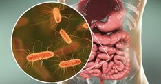 Picture of gut microbes in front of a picture of a human gut Human Digestive System, Improve Gut Health, Probiotics Supplement, Gut Microbiome, Beneficial Bacteria, Chronic Inflammation, Healthy Gut