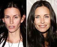 The fact that everyone tries so hard to look like the people we see on television while they are getting plastic surgery clearly shows we're chasing an unobtainable standard of beauty. It is really sick what we will do to oru healthy bodies. Courtney Cox Plastic Surgery, Bad Plastic Surgeries, Botox Before And After, Plastic Surgery Gone Wrong, Plastic Fantastic, Cheek Fillers, Makeup Before And After