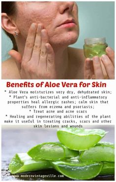 7 Amazing Homemade Beauty Products with Aloe Vera Benefits Of Aloe Vera, Aloe Vera For Skin, Homemade Beauty, Dehydrated Skin, How To Treat Acne, Homemade Beauty Products