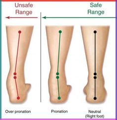 When your foot rolls inward a little too much, that’s when you can start to have problems. This is called overpronation, and it’s the leading cause of most runners’ injuries. It's estimated that 20-30% of runners are severe overpronators. Keep reading to learn how to reduce your risk of injury. Pronation Exercises, Ankle Strengthening Exercises, Knock Knees, Foot Anatomy, Ballet Technique, Outdoor Exercises, Knee Exercises, Diagram Design, Best Stretches