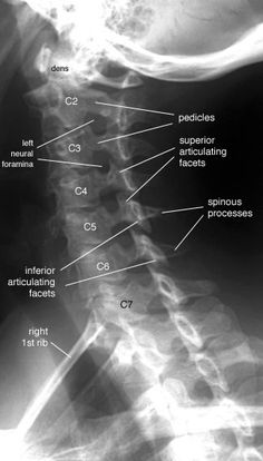 an x - ray shows the different types of bones and their corresponding structures in this image