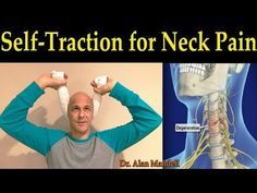 Pinched Nerve In Neck, Forward Head Posture, Bulging Disc, Neck Relief, Dr Mandell, Pinched Nerve