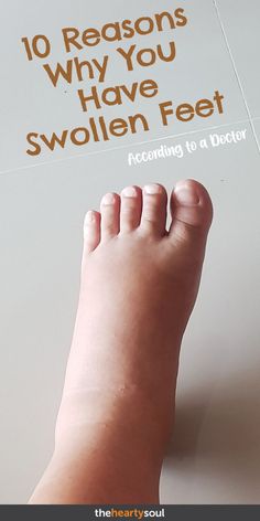 Swollen Feet Causes, Tomato Skin Care, Chronic Pain Relief, Healthy Diet Tips, Daily Health Tips, Lower Blood Sugar