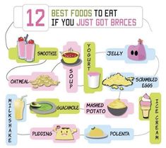 Great foods to eat after your braces are placed for the first time! #braces #invisalign Things To Eat When You Have Braces, Foods To Eat With Braces Soft, Foods To Eat When You Get Braces, Foods You Cant Eat With Braces List, Best Foods To Eat With Braces, Braces Must Haves, Soft Foods To Eat With Braces, Things You Can Eat With Braces, Food You Can Eat With Braces