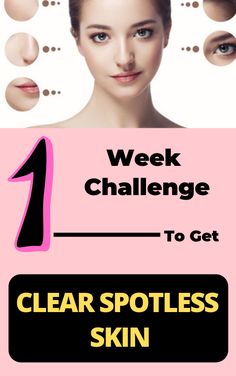 Week Skin Care Routine, 1 Week Challenge, Spotless Skin, Glowing Radiant Skin, Skin Care Routine For 20s, Week Challenge, Home Remedies For Hair, Skin Complexion, Lighten Skin