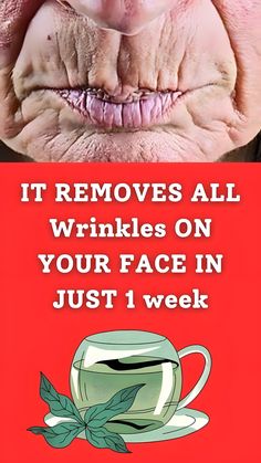 This Secret Ingredient Remove Wrinkles Easily at Home >>CHECK IT OUT Regular Skin Care Routine, Proper Skin Care, Best Skin Care Routine, Deep Wrinkles