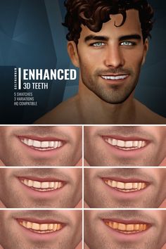 the teeth are all different shapes and sizes, but there is no image to describe