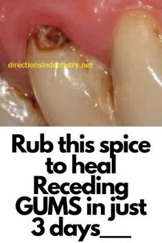 Tooth Scaling, Grow Back Receding Gums