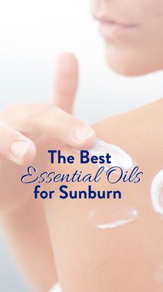 Oils For Sunburn Relief, Sunburn Relief Essential Oils, Essential Oils For Blisters, Skin Healing Essential Oils, Essential Oil For Burns, Sunburn Lotion, Essential Oil For Sunburn, Essential Oils For Fleas