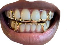 Gold Slugs Grillz Women, Wedding Grills Teeth, Women’s Grills, Grills For Women Teeth, Girly Grillz, Grillz For Women, Female Grills