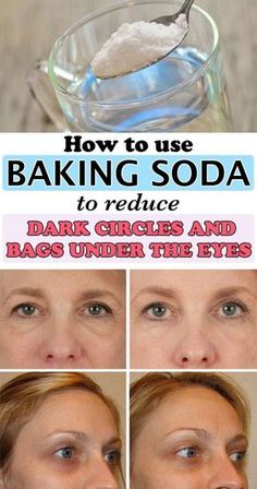 Baking Soda Under Eyes, Natural Hacks, Baking Soda Shampoo Recipe, Baggy Eyes, Face Treatments, Remove Eye Bags, Beauty Regime, Baking Soda Uses