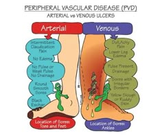 the diagram shows different types of venous